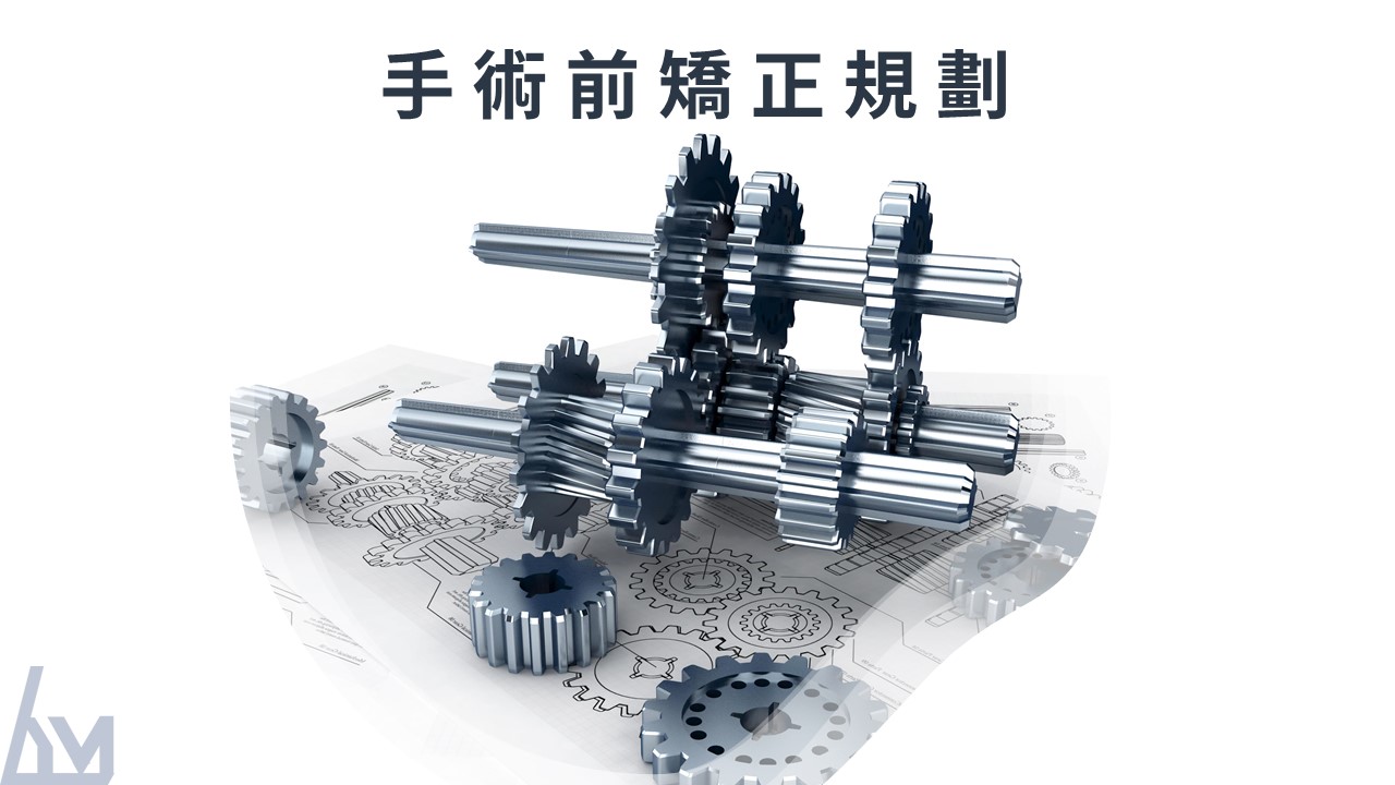 手術前矯正規劃