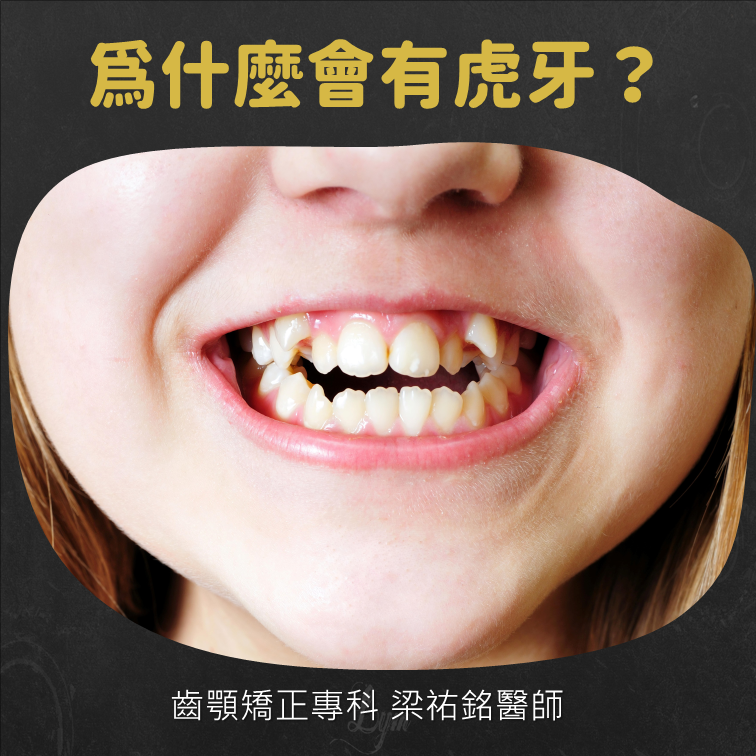 為什麼會有虎牙