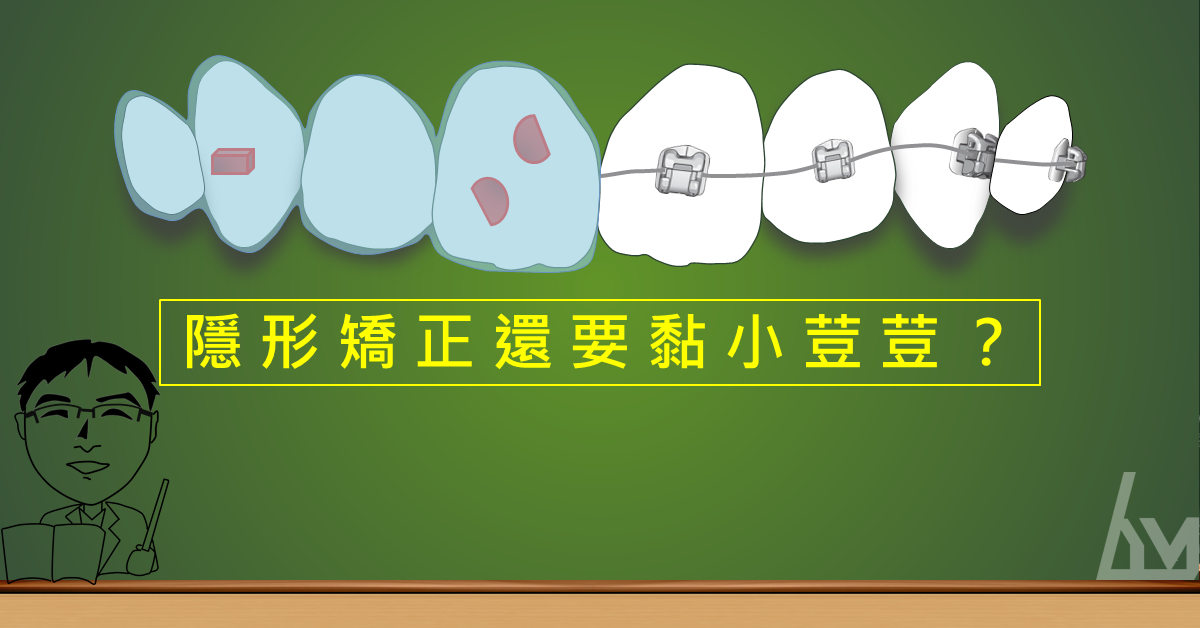 隱形矯正還要黏小荳荳？